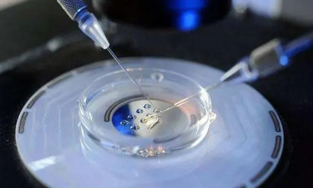 怎么选择冻胚移植子宫内膜的准备方案？(图1)