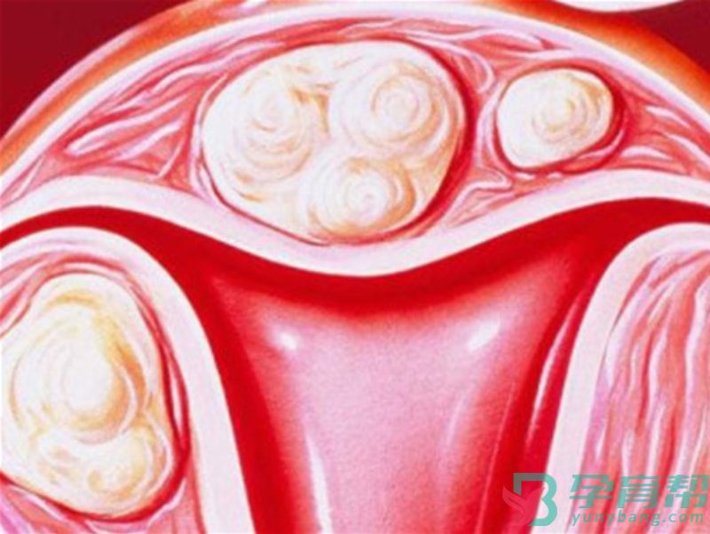 子宫内膜厚影响试管移植怎么办(图1)